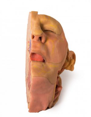 Head and Neck - Image 5
