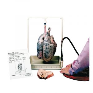 Smokers Lung Model
