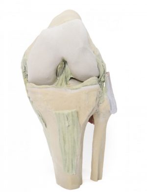 Model of Knee Joint in the Flex Position