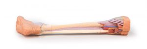 Lower Limb Deep Dissection - Image 4