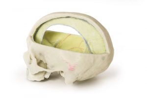 Dural Skull MA01159 - Image 6