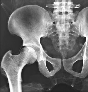 Full Body X Ray Phantom - Image 6