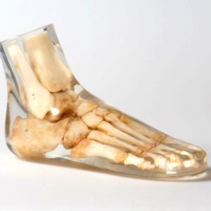 X Ray Phantom Foot Transparent