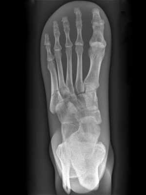 X Ray Phantom Foot Opaque