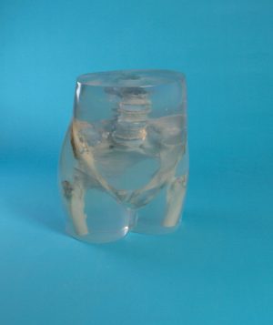 Pelvis Phantom to Radiology Transparent - Image 4