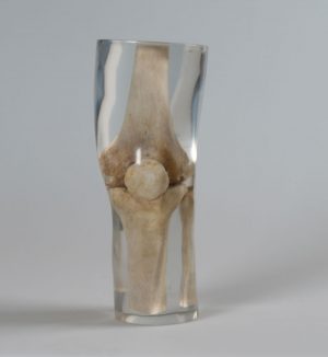 X Ray Phantom Knee Transparent