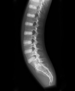 X Ray Phantom Spine Opaque - Image 2
