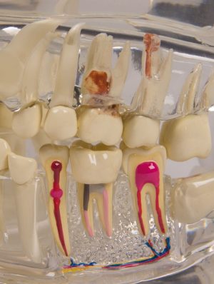Clear Human Jaw with Teeth - Image 2