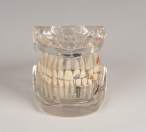 Clear Human Jaw with Teeth - Image 3