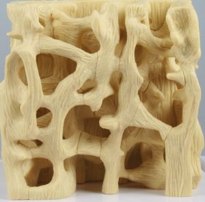 Healthy Osteoporotic Bone Structure Comparison Model - Image 3