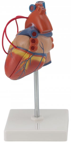 Heart with Bypass MA01192