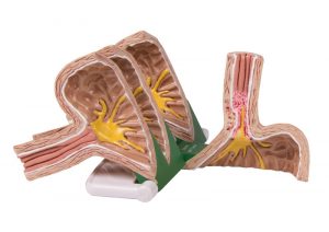 Gastroesophageal Reflux Diseas - Image 2