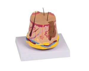 Skin Acne Model - Image 2
