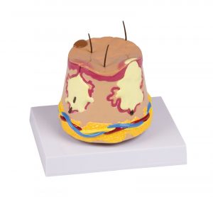 Skin Acne Model