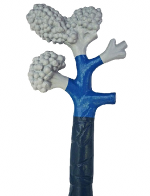 Bronchioles