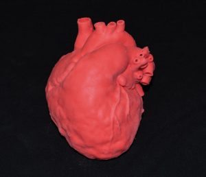 Pediatric Heart with Atrial Septal Defect ASD G560EZ - Image 3