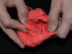 Pediatric Heart with Tetralogy of Fallot G580EZ - Image 2