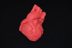 Pediatric Heart with Tetralogy of Fallot G580EZ - Image 3