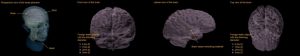 Head Phantom Static for MRI CT and Ultrasonography - Image 2