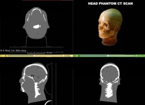 Head Phantom Static for MRI CT and Ultrasonography - Image 3