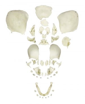 Disarticulated Human Fetal Skull Full Term