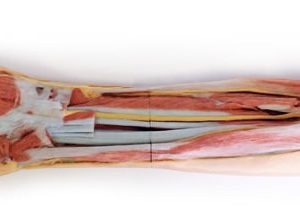 Forearm and Hand Superficial and Deep Dissection