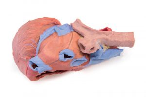 Heart and the Distal Trachea Carina and Primary Bronchi - Image 5
