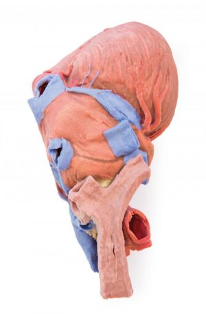 Heart and the Distal Trachea Carina and Primary Bronchi - Image 6