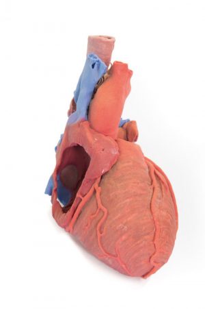 Heart and the Distal Trachea Carina and Primary Bronchi - Image 7
