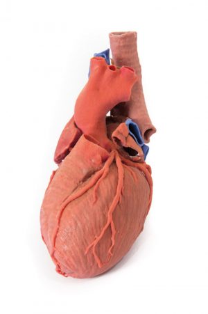 Heart and the Distal Trachea Carina and Primary Bronchi - Image 8