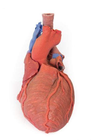 Heart and the Distal Trachea Carina and Primary Bronchi - Image 9