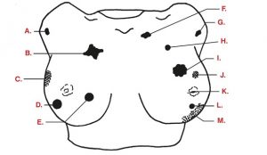 Advanced Breast Exam Simulator - Image 3