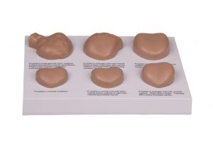 Prostate Diseases