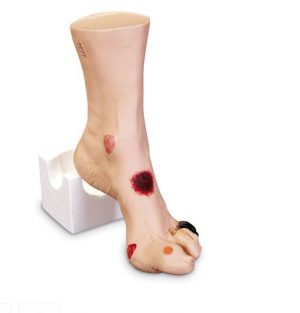 Wound Foot - Image 2