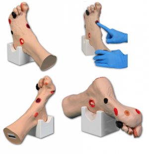Wound Foot - Image 3