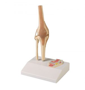 Miniature Knee Joint with Cross Section