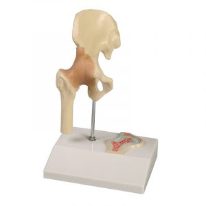 Miniature Hip Joint with Cross Section