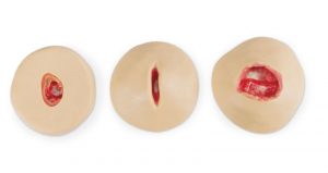 Negative Pressure Wound Therapy NPWT Trainers - Image 2