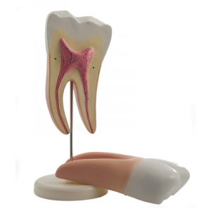 Tooth Models Disassemblable - Image 2