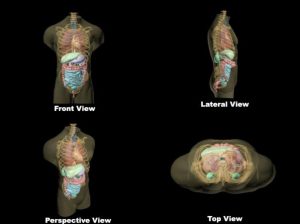 Torsophantom for Emergency Ultrasonography + FAST Protocol Skin Version - Image 3