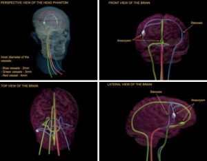 Adult Head Phantom Dynamic for MRI CT and Ultrasonography - Image 2
