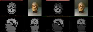 Adult Head Phantom Dynamic for MRI CT and Ultrasonography - Image 3