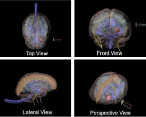 Advanced Adult Brain Phantom for Diagnosis of MRI CT and Ultrasound - Image 2