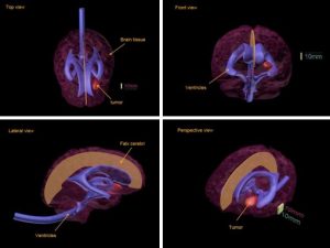 Standard Adult Brain Phantom for Diagnosis of MRI CT and Ultrasound - Image 3