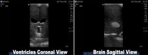 Standard Adult Brain Phantom for Diagnosis of MRI CT and Ultrasound - Image 4