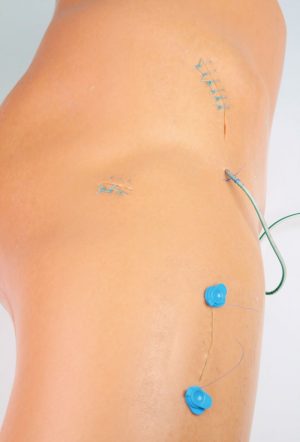 Fleximodel Suture Leg