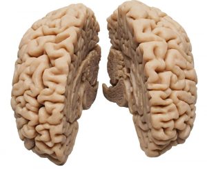 Human Brain Model Natural Cast