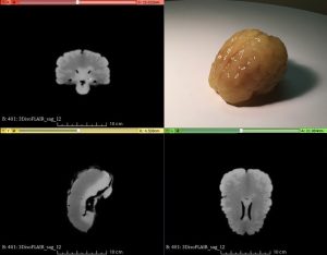 Adult Brain Phantom for Puncture/Biopsy Under Ultrasound Guidance Basic - Image 2