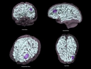 Adult Brain Phantom for Puncture/Biopsy Under Ultrasound Guidance Basic - Image 4