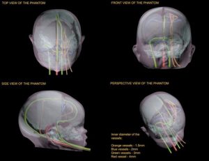 Newborn Head Phantom for MRI CT and Ultrasound Diagnostics Dynamic - Image 2